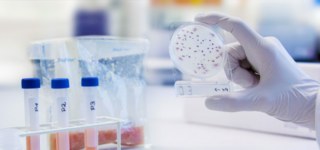 Bsc Microbiology Colleges in Bangalore